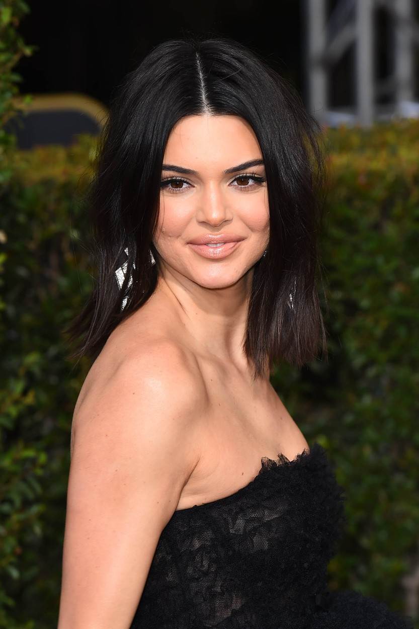 Kendall Jenner nekada se borila s aknama