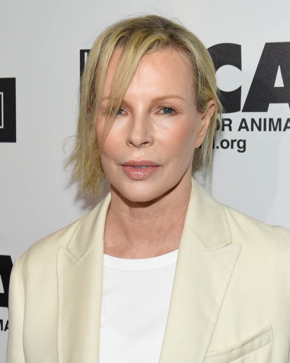 Kim Basinger pretjerala je s operacijama