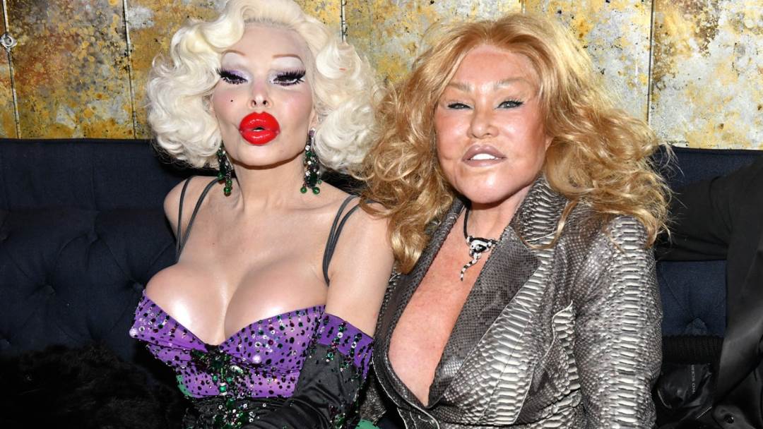 Jocelyn Wildenstein dobila je nadimak 'Žena mačka'