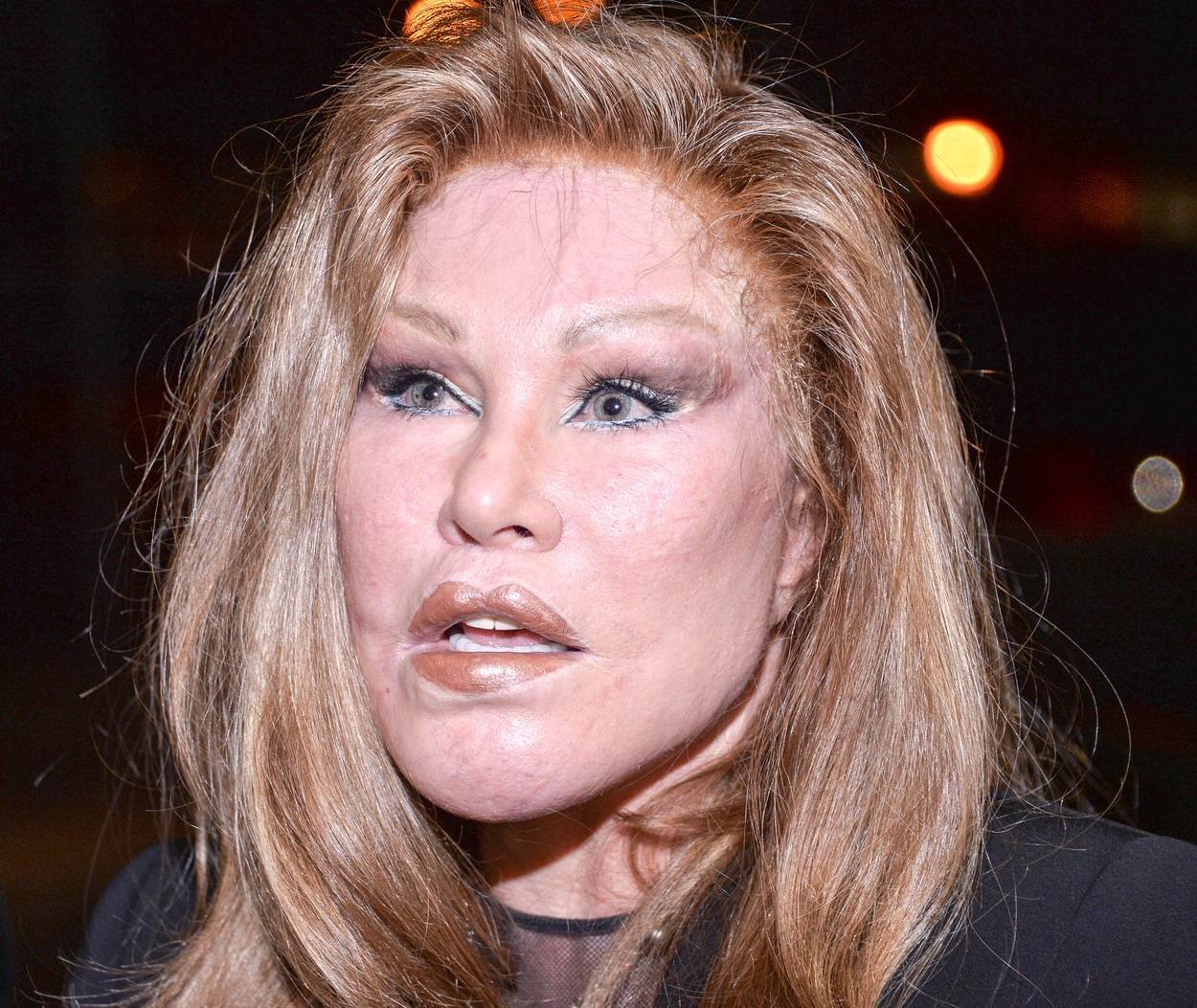 Jocelyn Wildenstein svoje je lice unakazila plastičnim operacijama