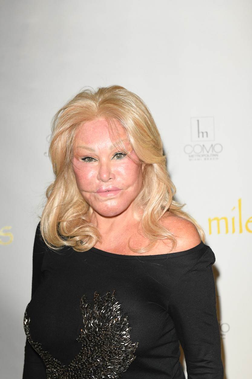 Jocelyn Wildenstein opsjednuta je plastičnim operacijama