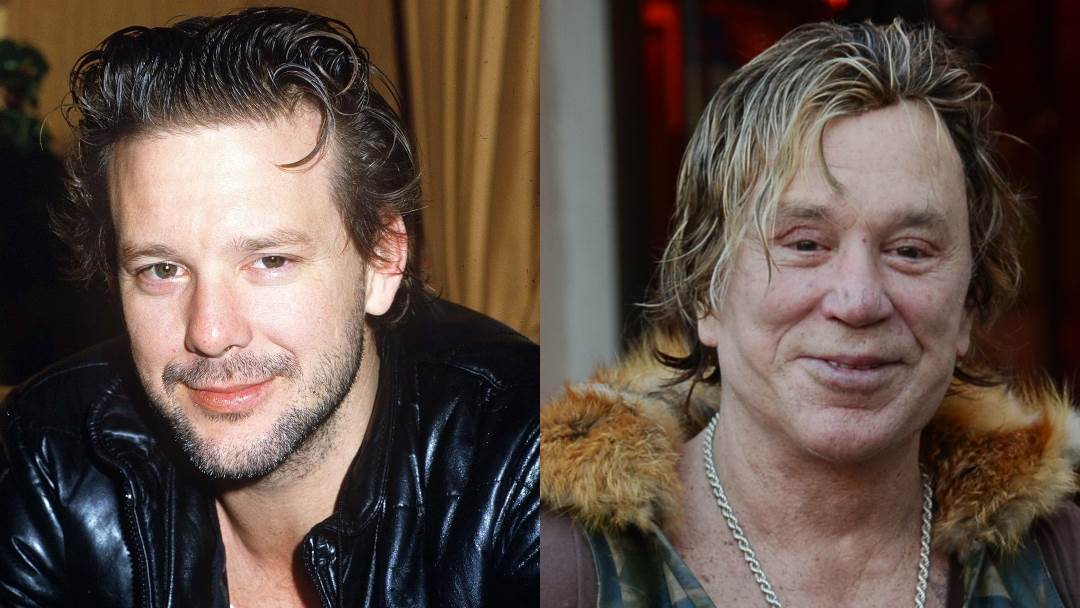 Mickey Rourke plastičnim je operacijama unakazio svoje lice