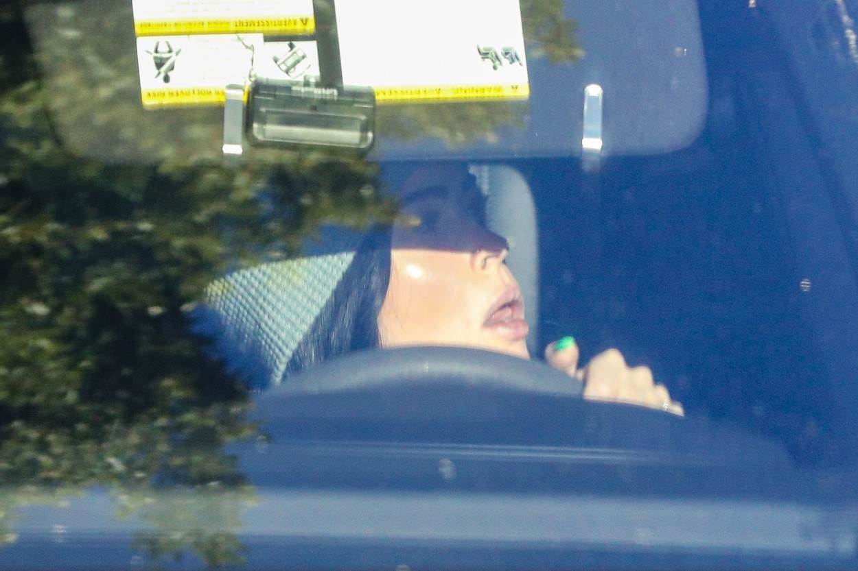 Megan Fox je povećala usne