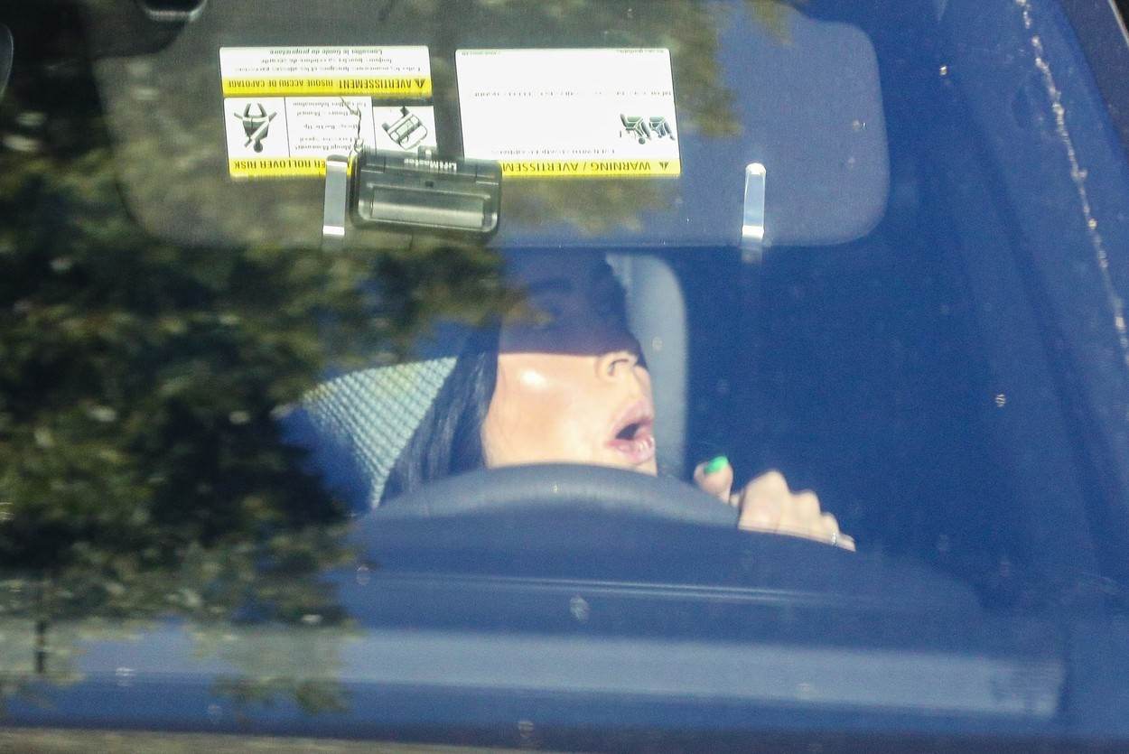 Megan Fox je povećala usne