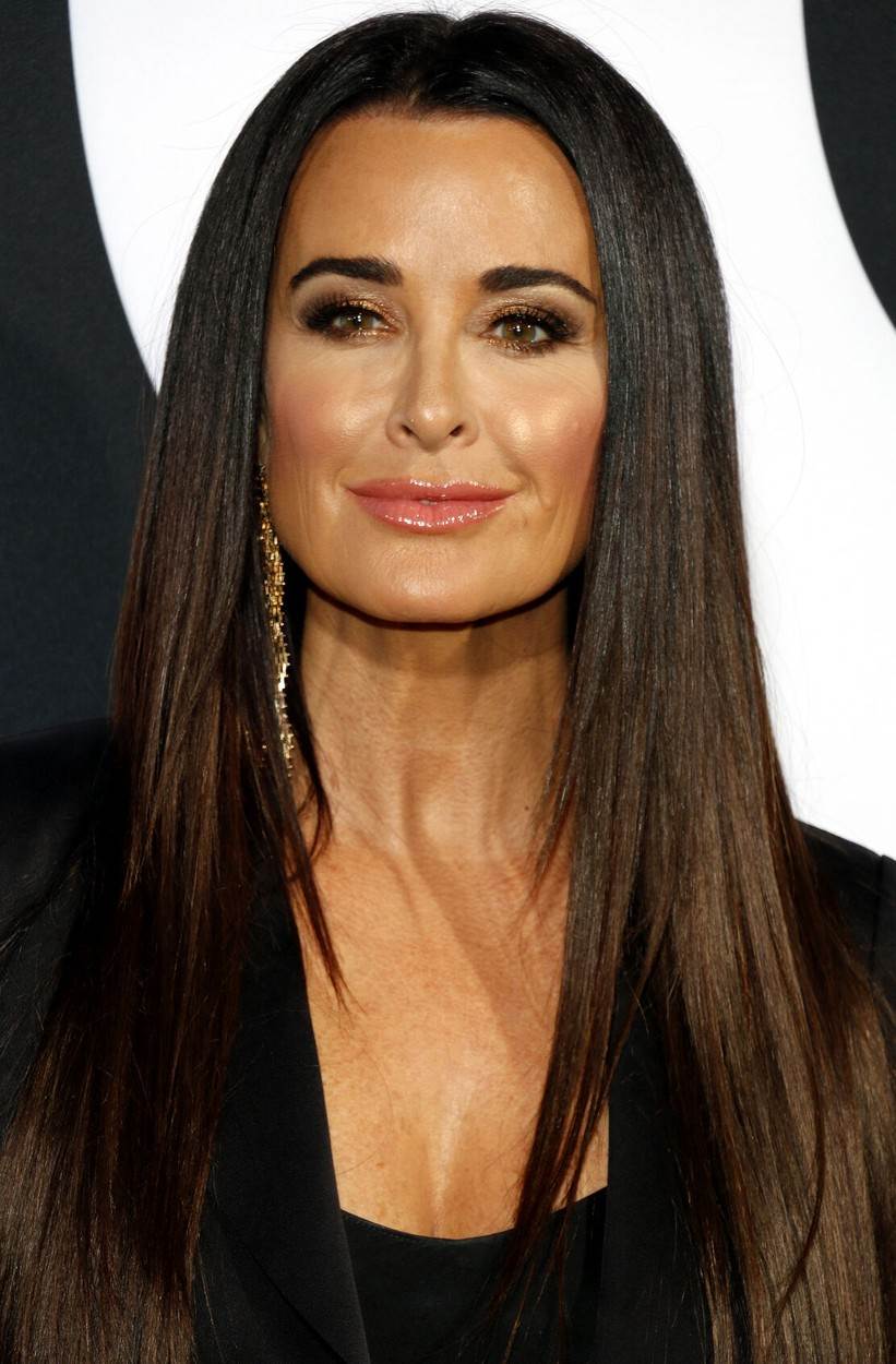 Kyle Richards na Instagramu je priznala operaciju