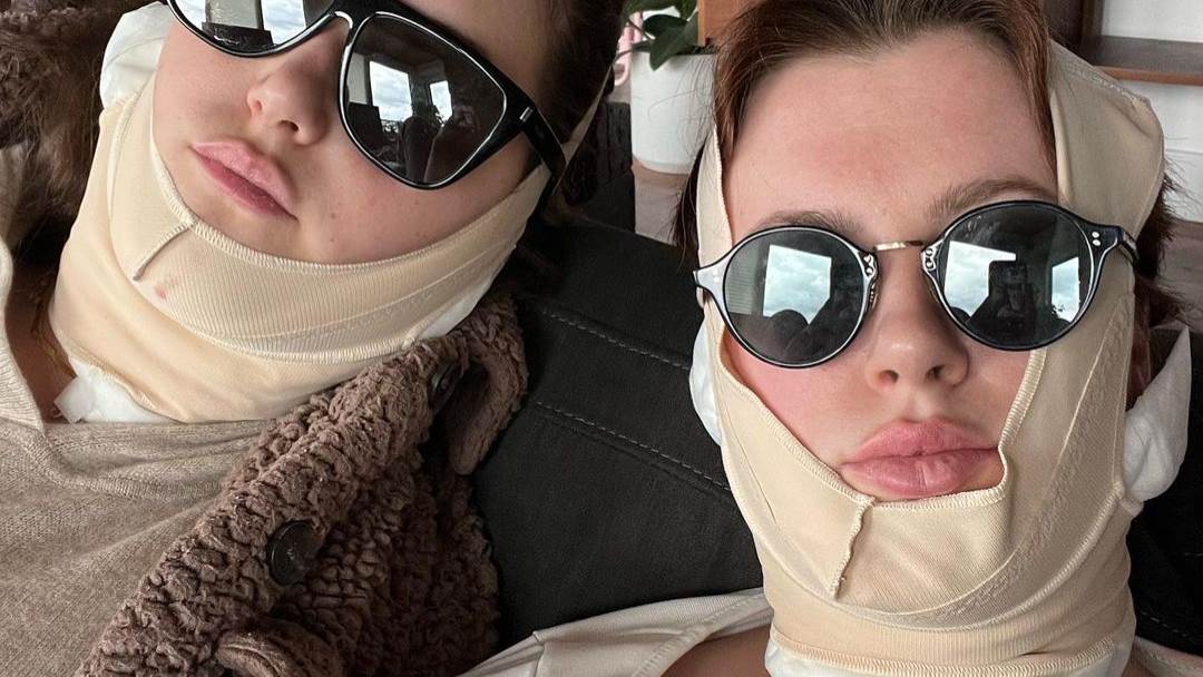 Ireland Baldwin isprobala je neinvazivni tretman lica 'FaceTite'