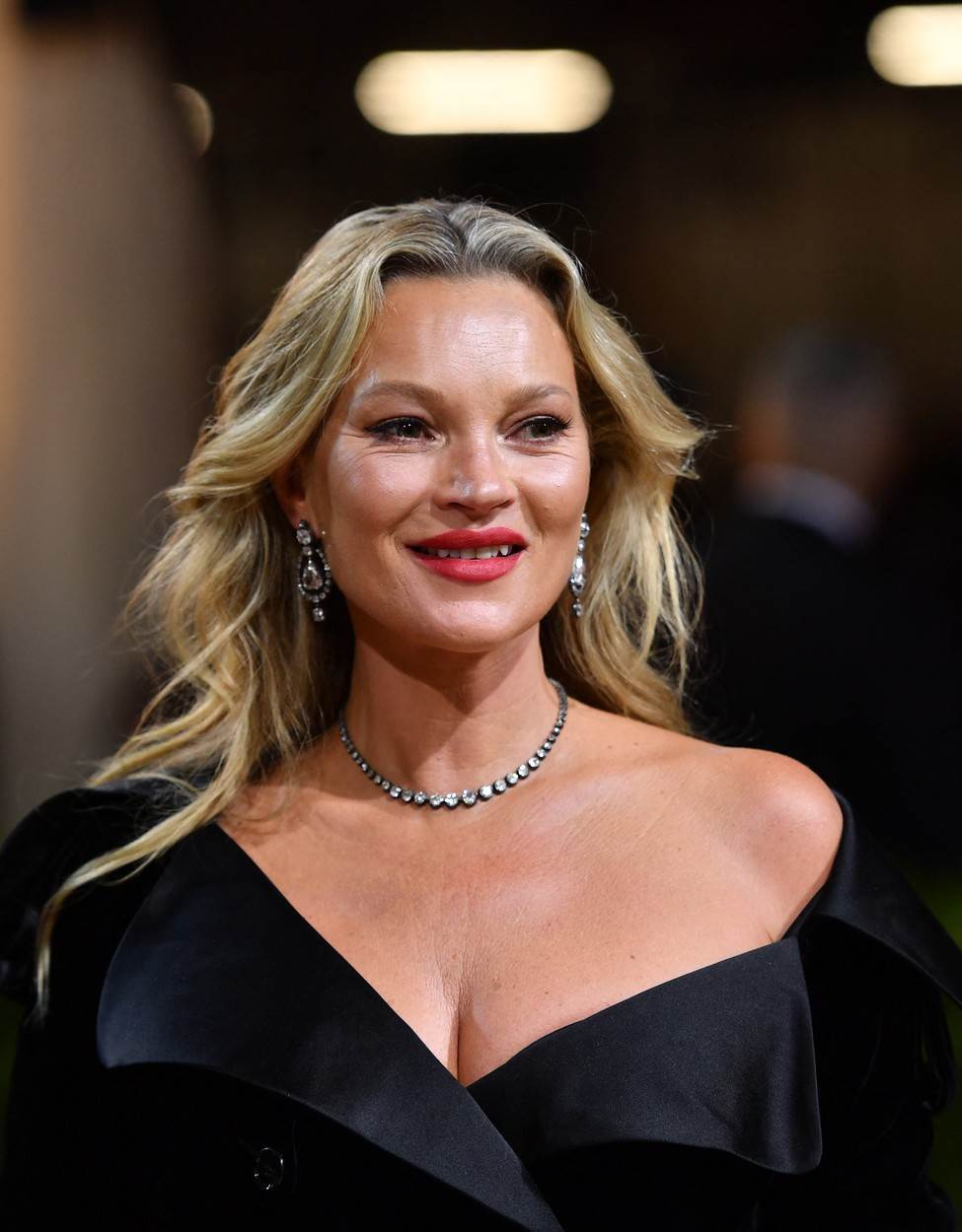 Kate Moss jedva može pomicati lice