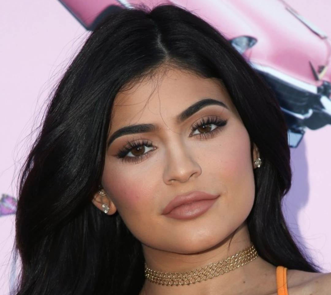 Kylie Jenner povećala je usne privremenim filerima