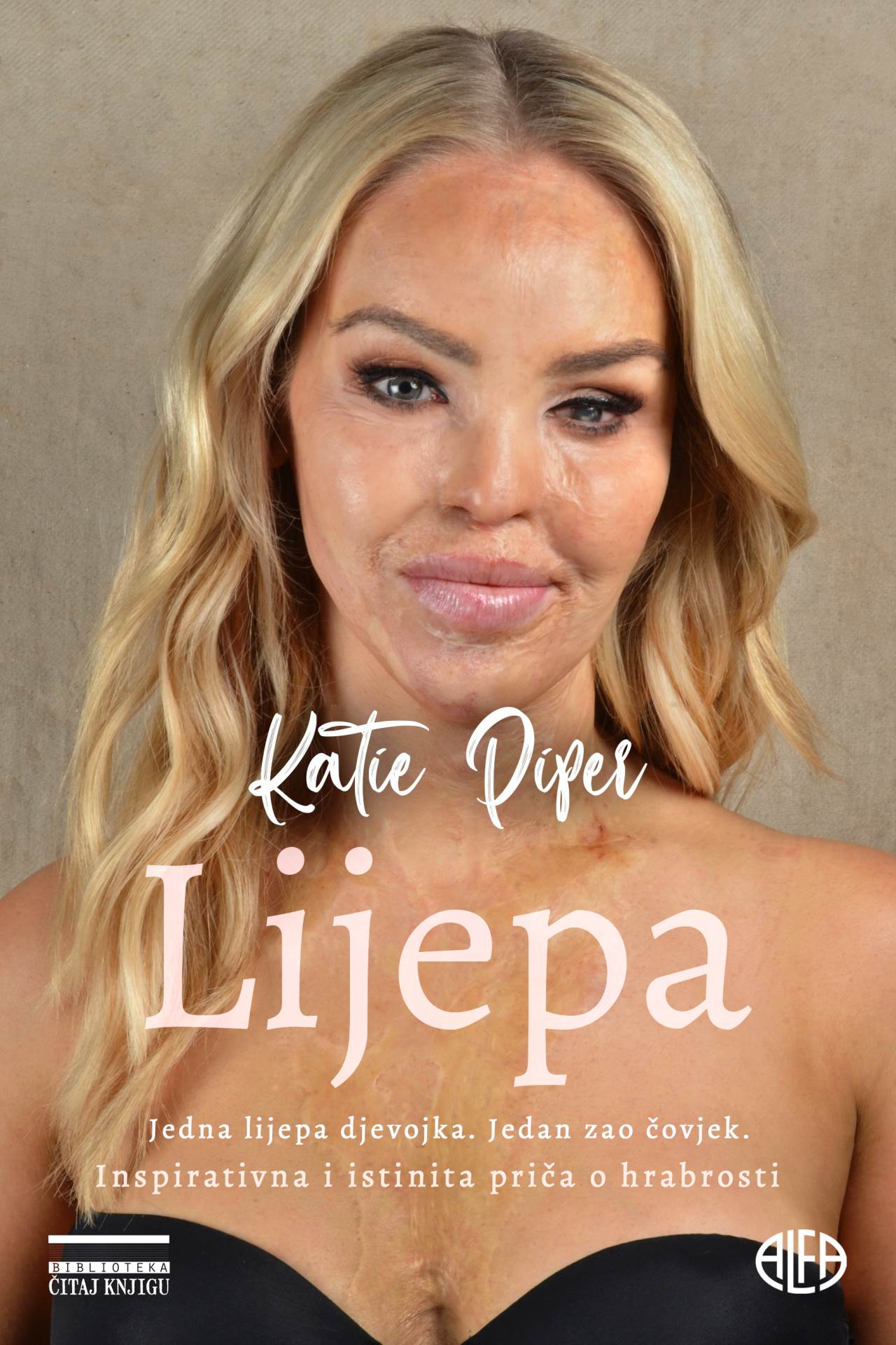 Katie Piper objavila je knjigu pod nazivom 'Lijepa'