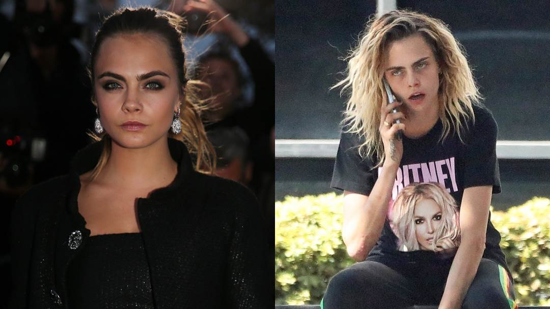 Cara Delevingne treba stručnu pomoć