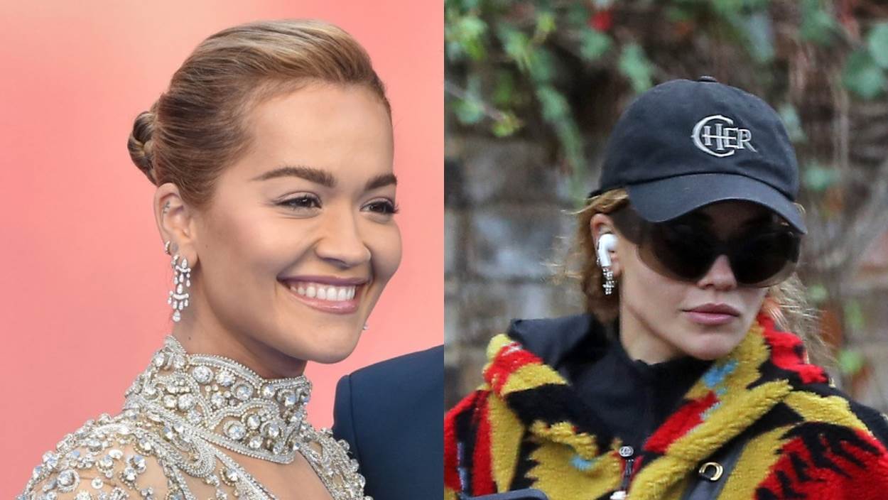 Rita Ora podvrgla se preoblikovanju čeljusti hijaluronskim filerima