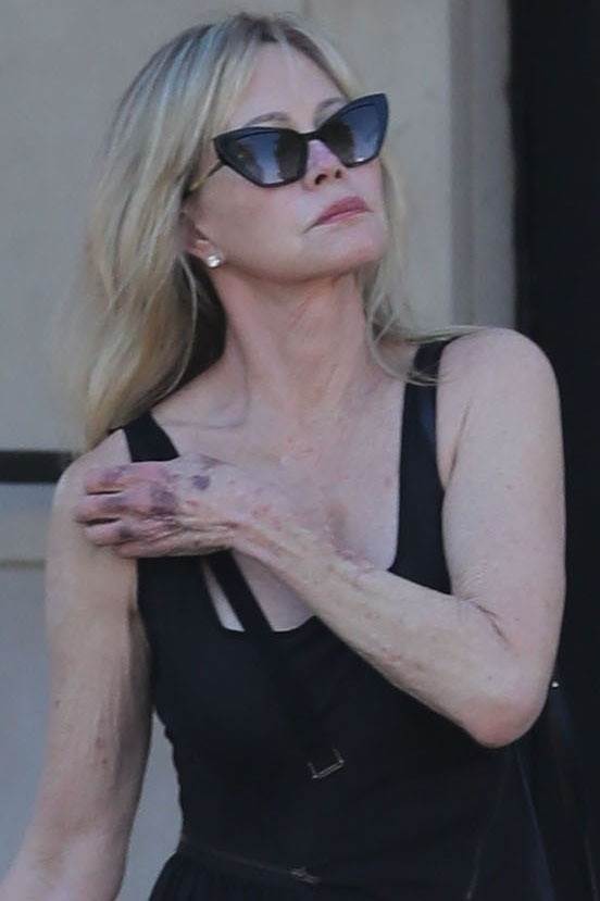 Melanie Griffith
