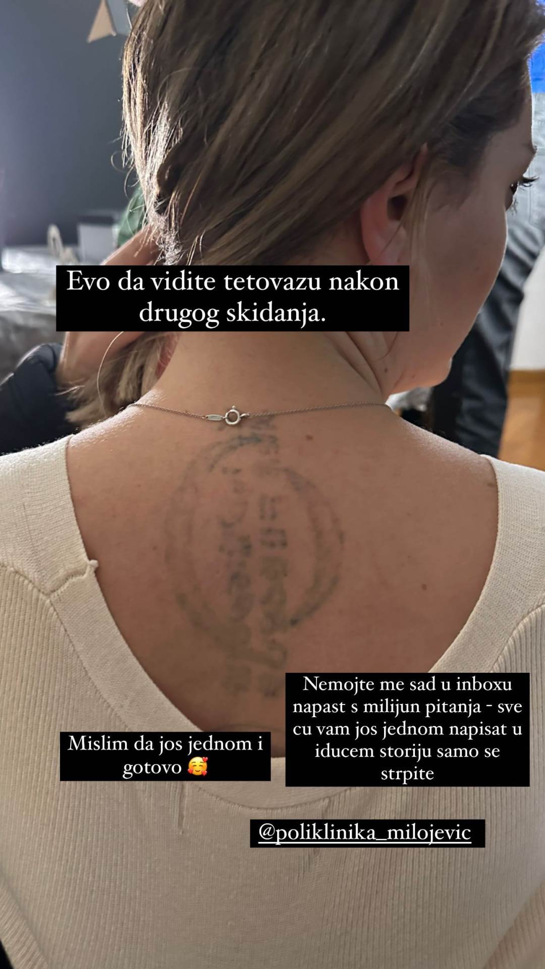 Ella Dvornik je odlučila ukloniti tetovažu