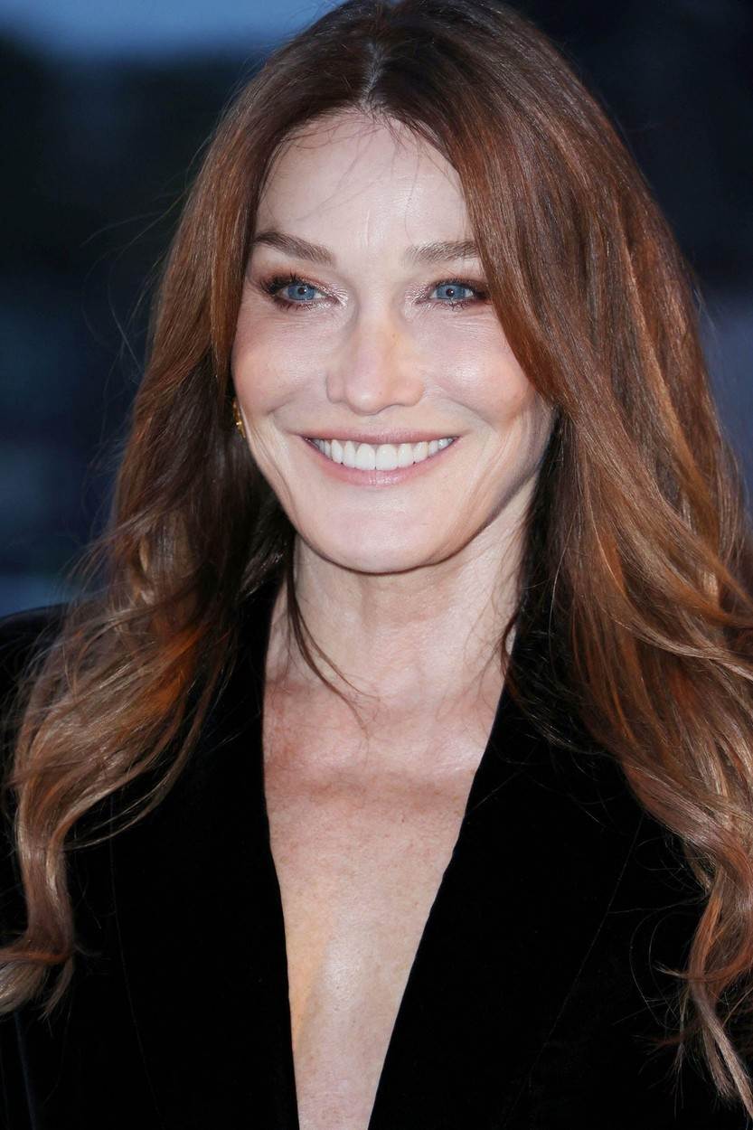 Carla Bruni uništila si je izgled botoksom