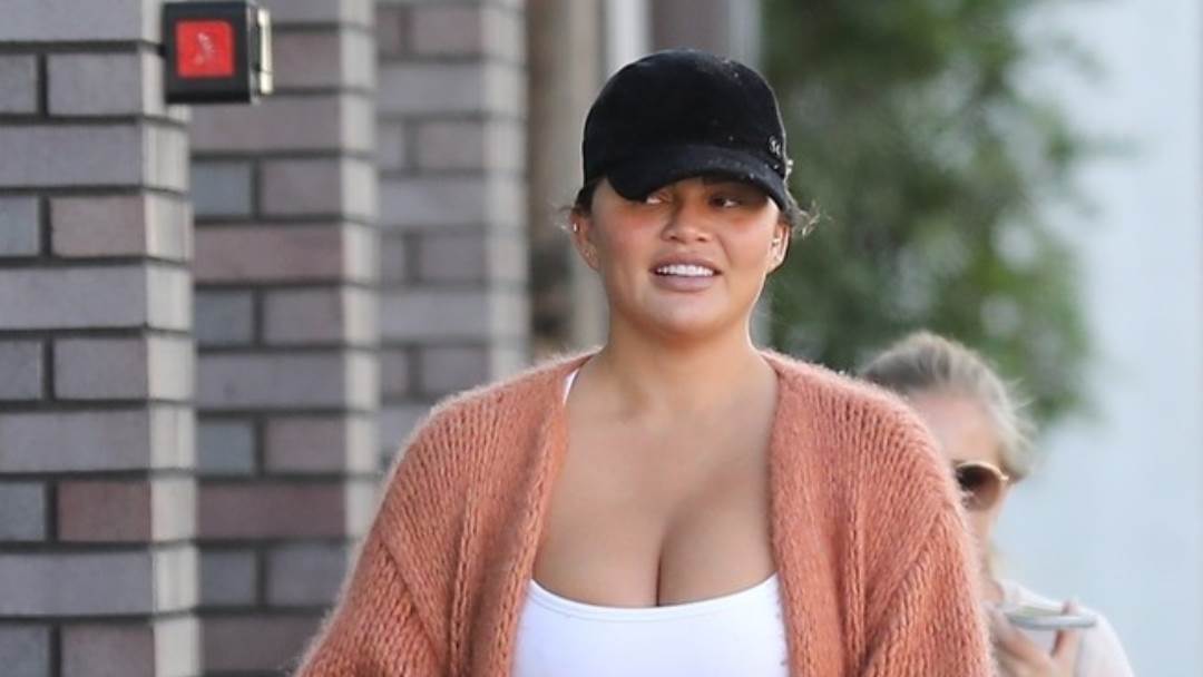 Chrissy Teigen nema komplekse