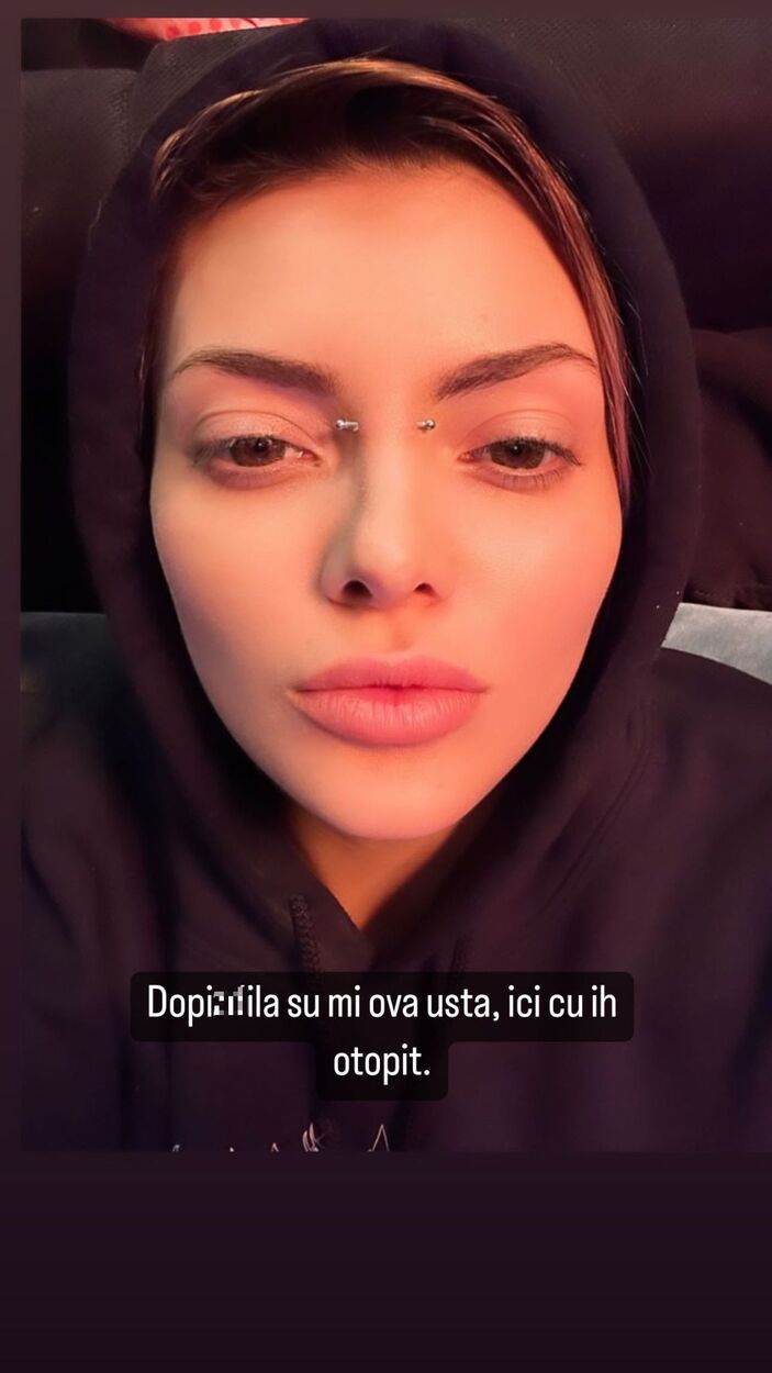 Ella Dvornik razmišlja da smanji usne