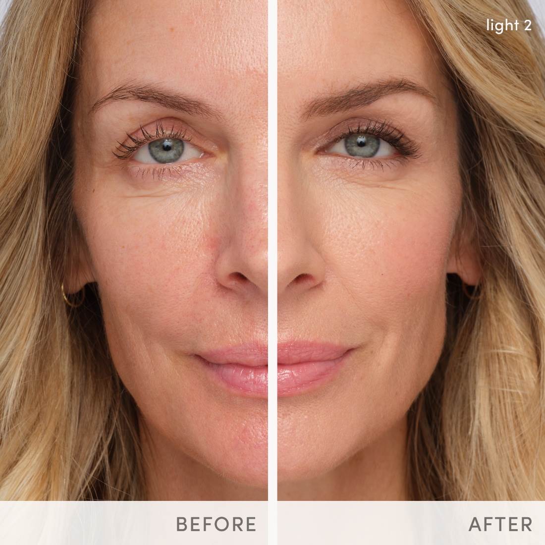 HydroPureTintedSerum_before-and-after-svetlana-2.jpg