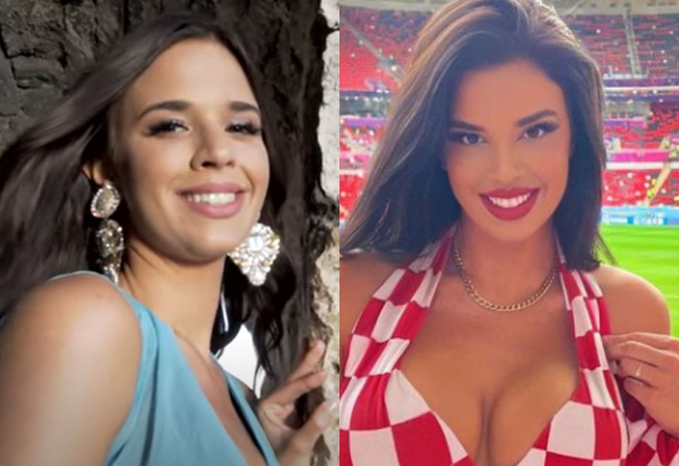 Kako je Ivana Knoll izgledala prije operacija?