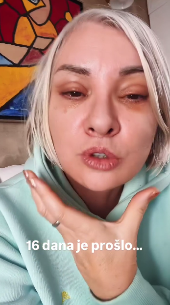 Danijela Dvornik pokazala lice 16 dana nakon faceliftinga