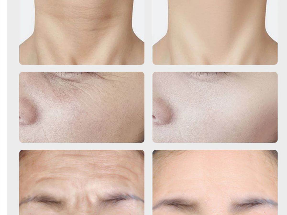 Otklonite bol, poboljšajte izgled i izgledajte mlađe