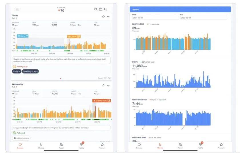 Cardiogram Heart Rate Monitor.jpg