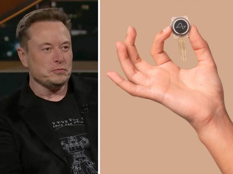 Elon Musk-mozdani-implant-prvi-ljudski-pacijent.jpeg