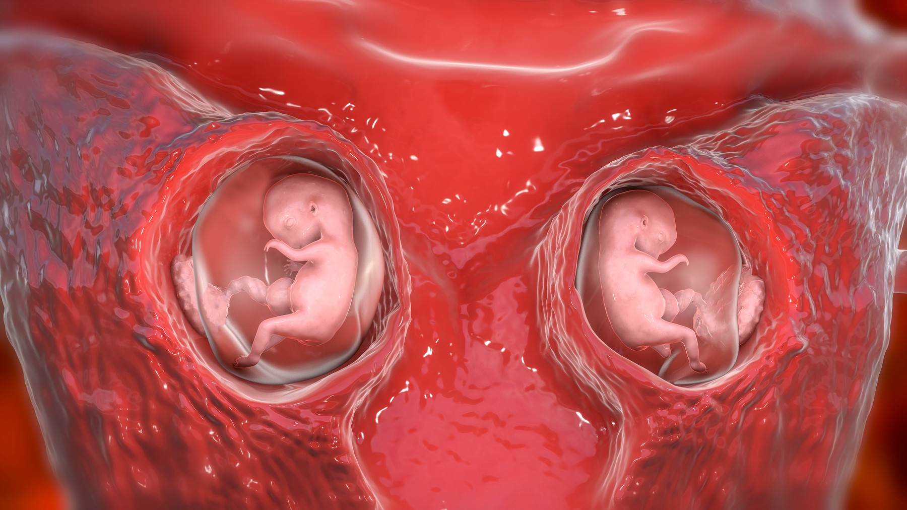 razlika-izmedu-jednojajcanih-dvojajcanih-blizanaca