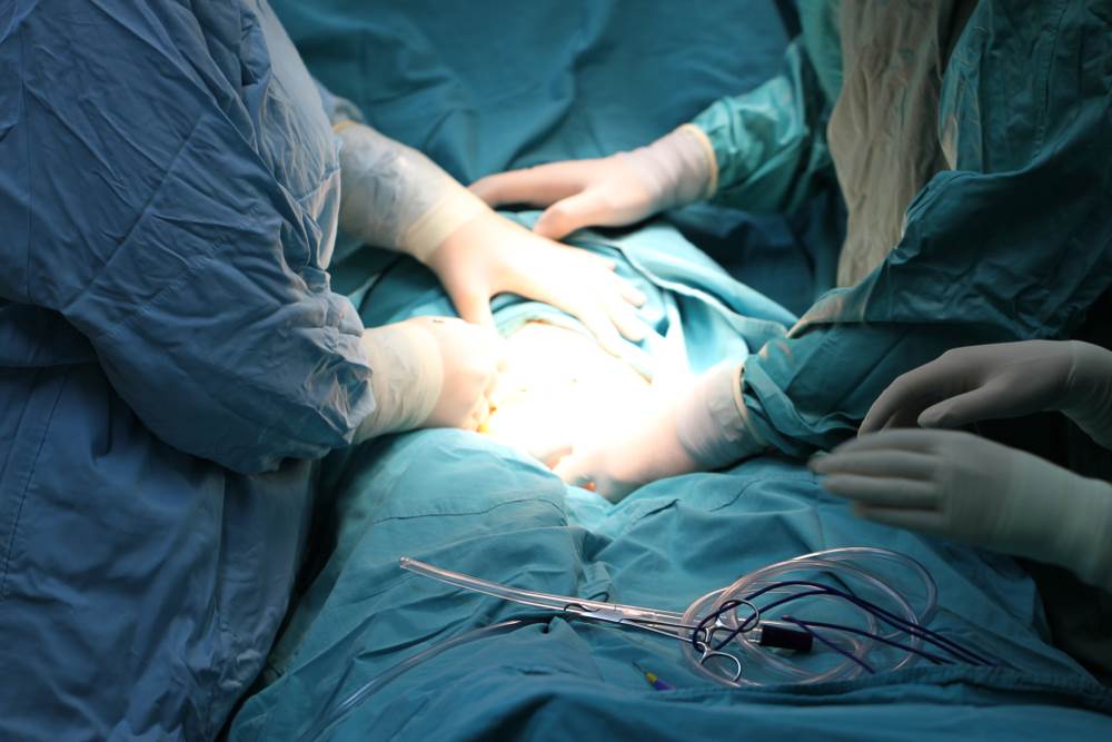 8 stvari koje nisam znala prije carskog reza