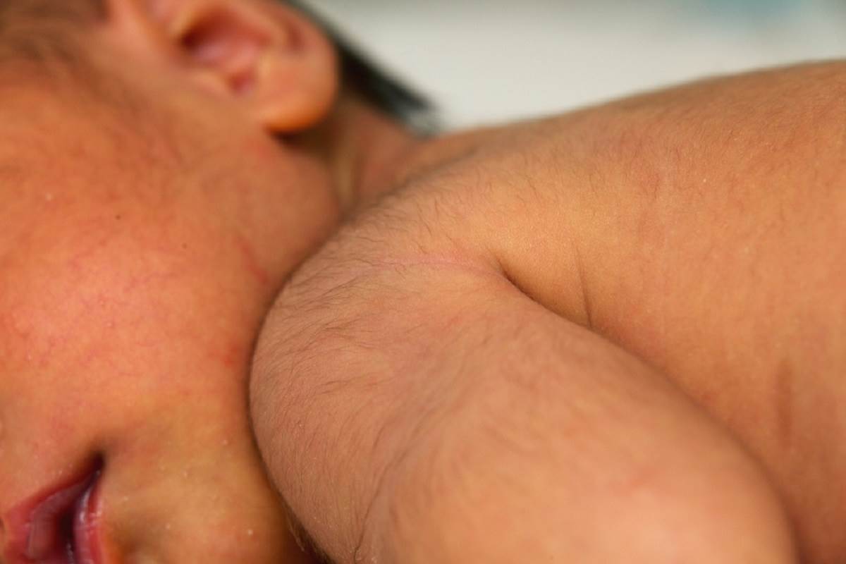 Zašto se neke bebe radaju s kosom, a druge celave