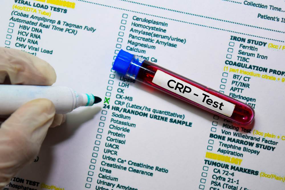 bakterijska-ili-virusna-infekcija