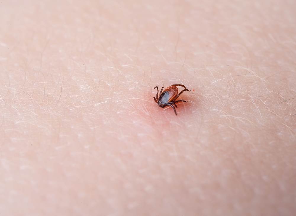 kako izvaditi krpelja i sprijeciti pojavu infekcije