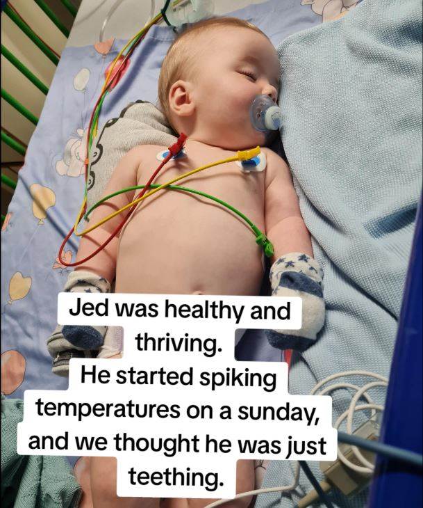 Djecak pretrpio oštecenja mozga zbog virusa herpes