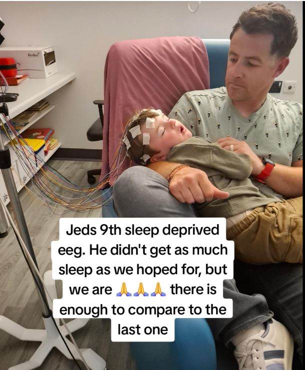 Djecak pretrpio oštecenja mozga zbog virusa herpes