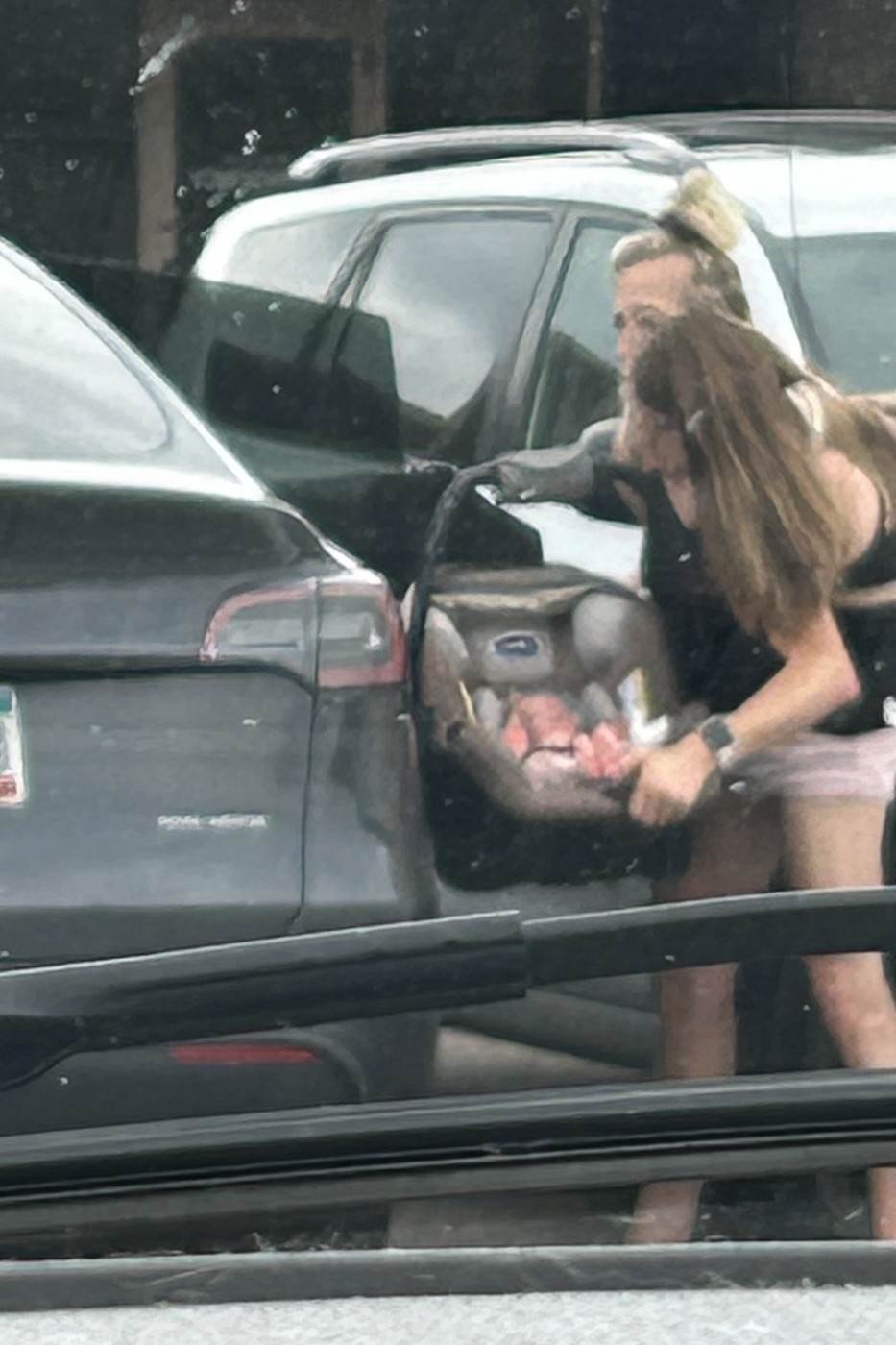 Sijamske blizanke koji dijele vaginu rodile dijete